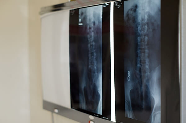 骨や関節の画像検査