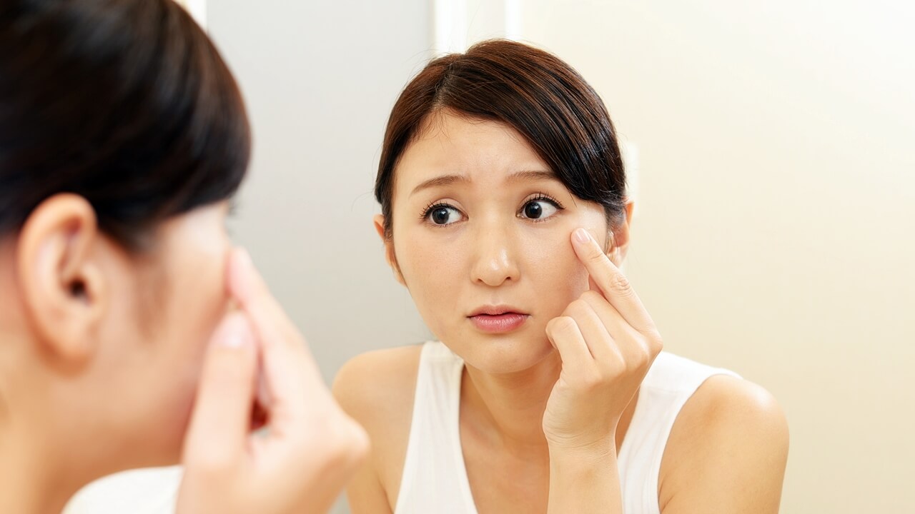 シミとそばかすの違いは？セルフケアで薄くできるのはどっち？